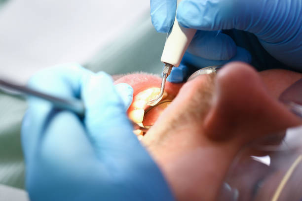  West Rson, CA Emergency Dentist Pros